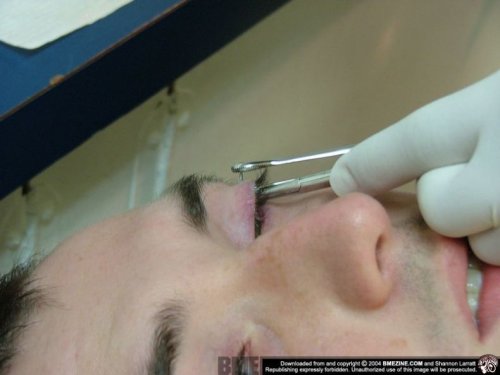eyelid-pircing-08.jpg