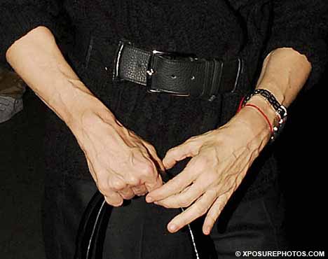 madonna-cosmetic-surgery-hands.jpg
